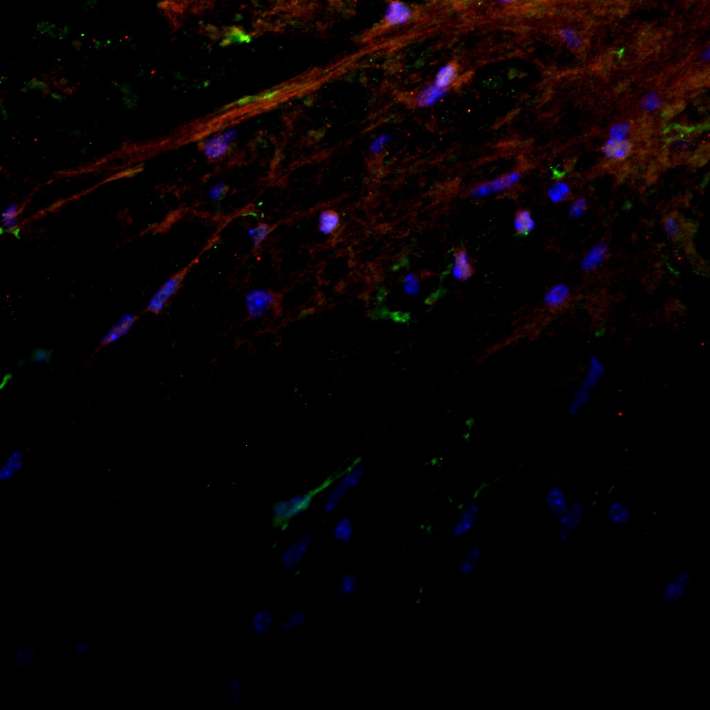 AIF-1/Iba1 Antibody NB100-1028