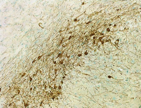Human/Mouse Tyrosine Hydroxylase Antibody MAB7566