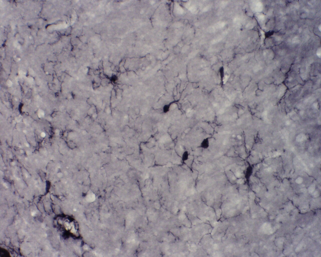 AIF-1/Iba1 Antibody NB100-1028