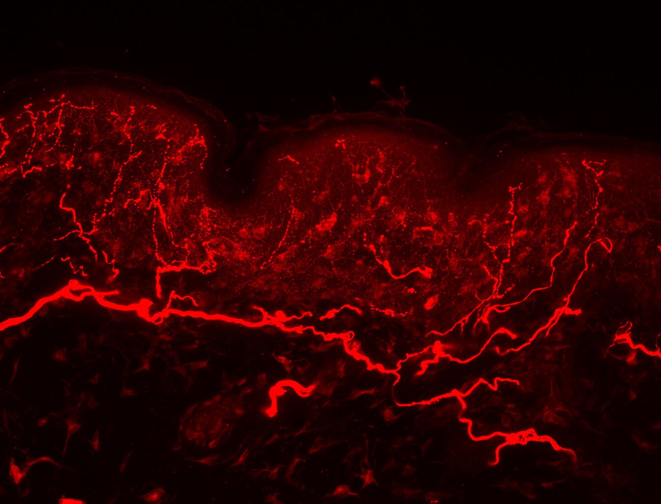 UCH-L1/PGP9.5 Antibody - BSA Free NB300-676