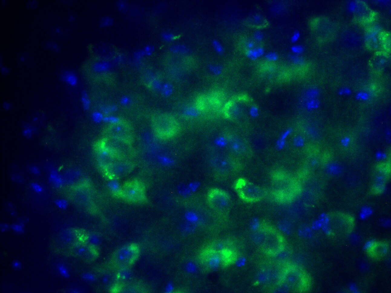 Casein Kinase 1 delta Antibody NBP1-21376