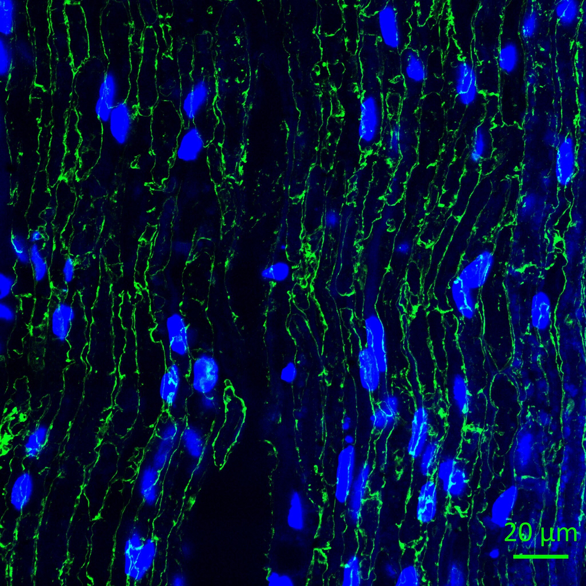 Periaxin Antibody - BSA Free NBP1-89598