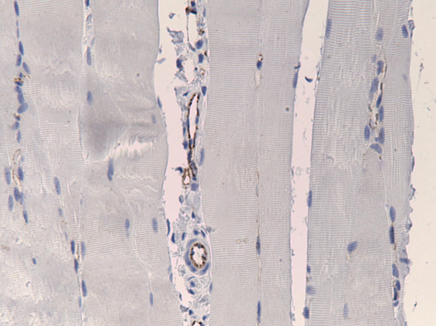 CD31/PECAM-1 Antibody NB100-2284