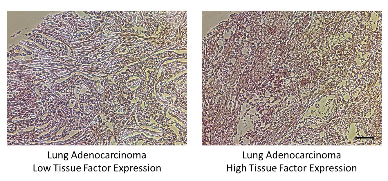 Coagulation Factor III/Tissue Factor Antibody NBP2-15139