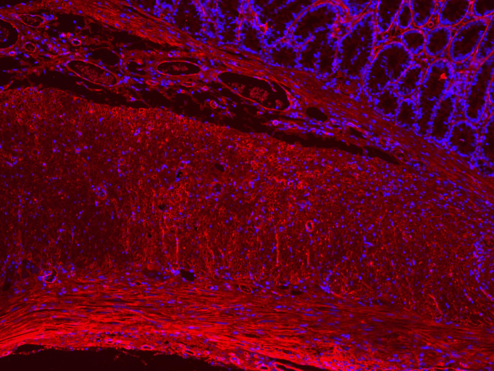 Collagen I Antibody - BSA Free NB600-408