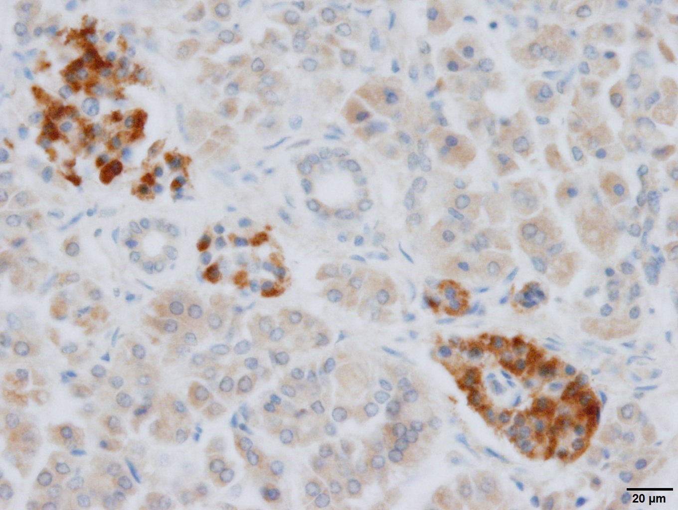 FGF-3 Antibody (MSD1) - BSA Free NB200-603