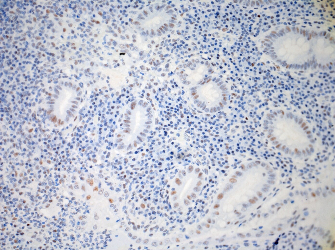 IL-23R Antibody (15N6C6) - BSA Free NBP2-27091