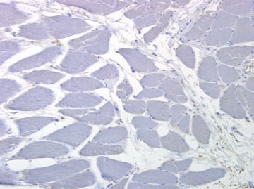 ST2/IL-33R Antibody - BSA Free NBP1-85251