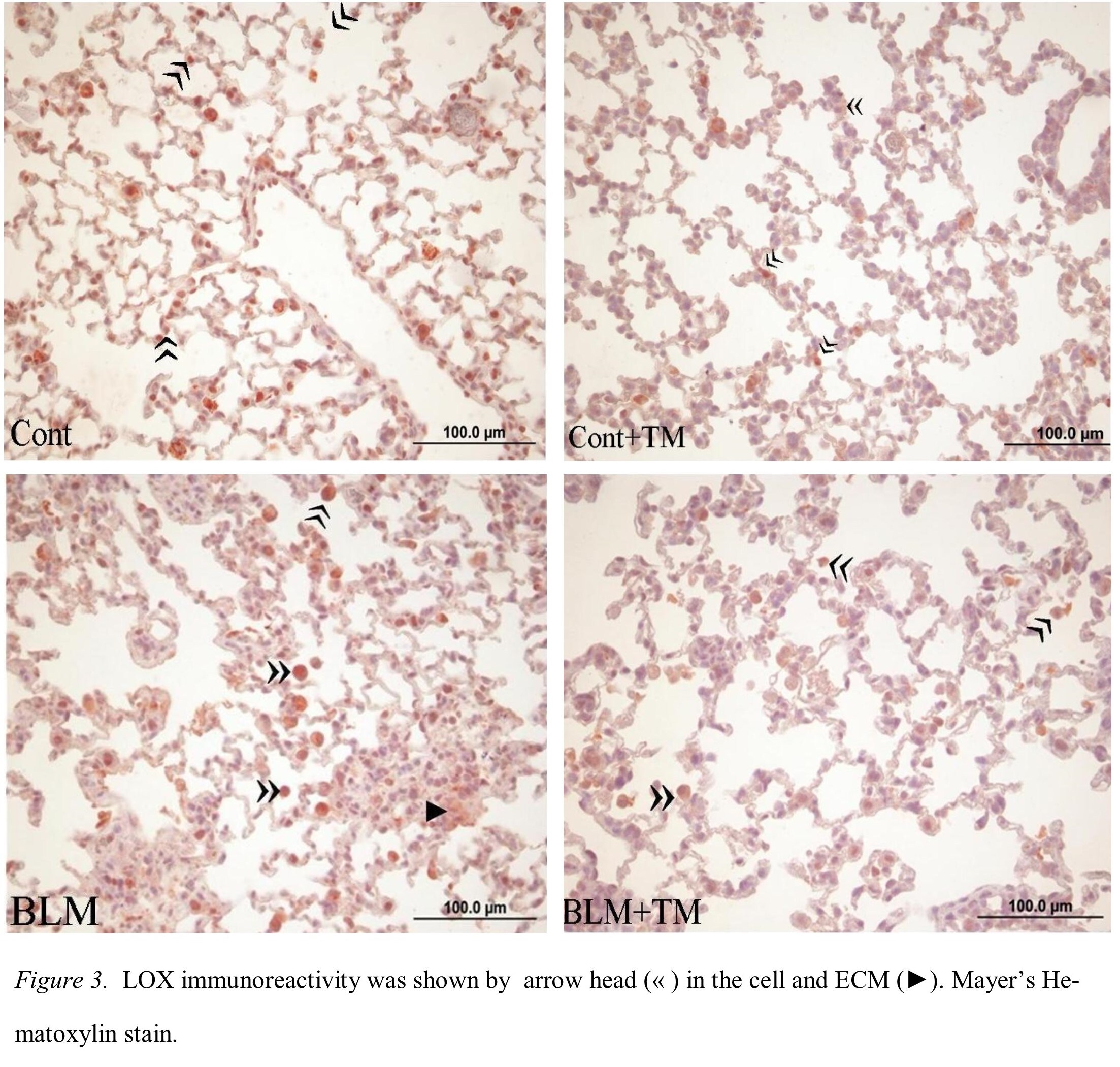 LOX Antibody - BSA Free NB100-2527