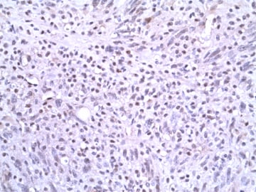 Slug Antibody (OTI1A6) NBP2-03886