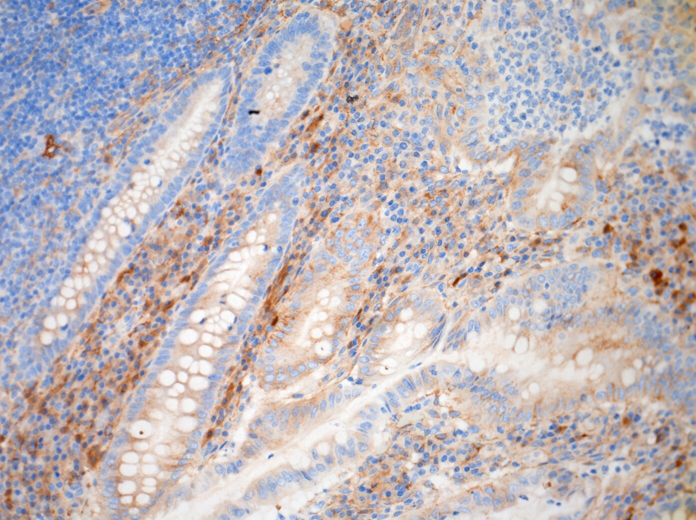 TGF-beta 1 Antibody - BSA Free NBP1-80289