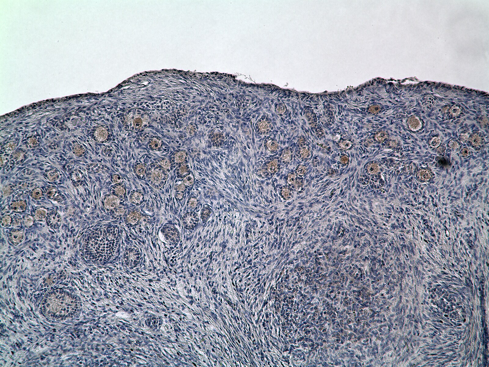 Human Activin RIIB Antibody AF339
