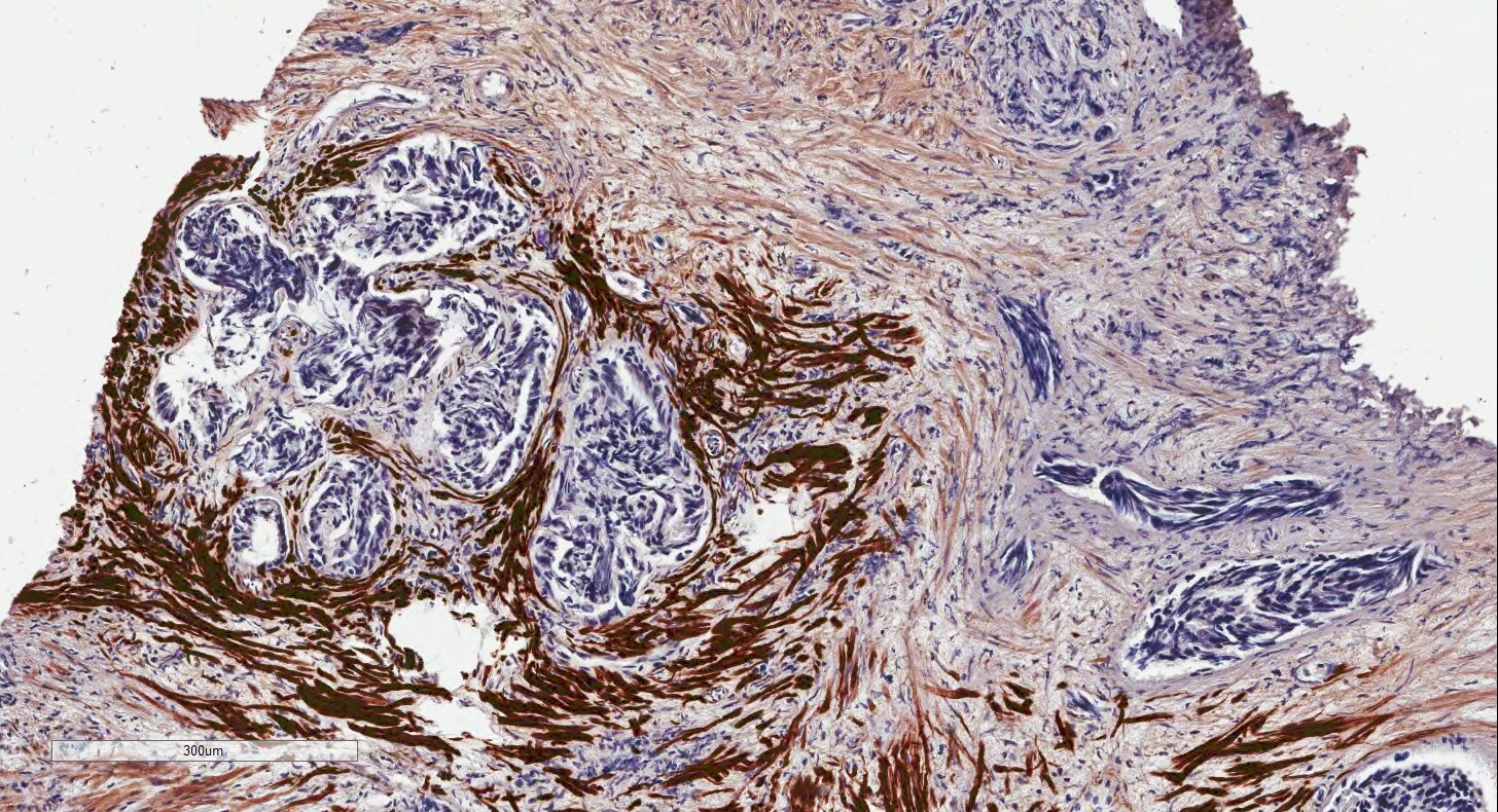 Human Cadherin‑11 Antibody MAB1790