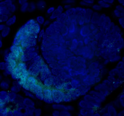 FoxC2 Antibody NB100-1269