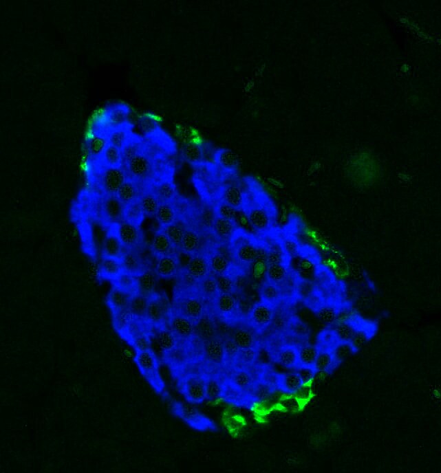 Pancreatic Polypeptide/PP Antibody NB100-1793