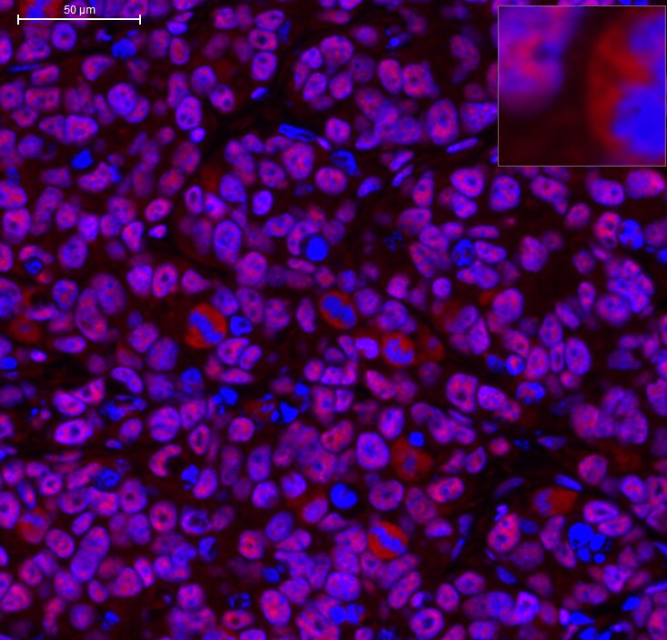RNA Polymerase II/POLR2A [p Ser2] Antibody NB100-1805