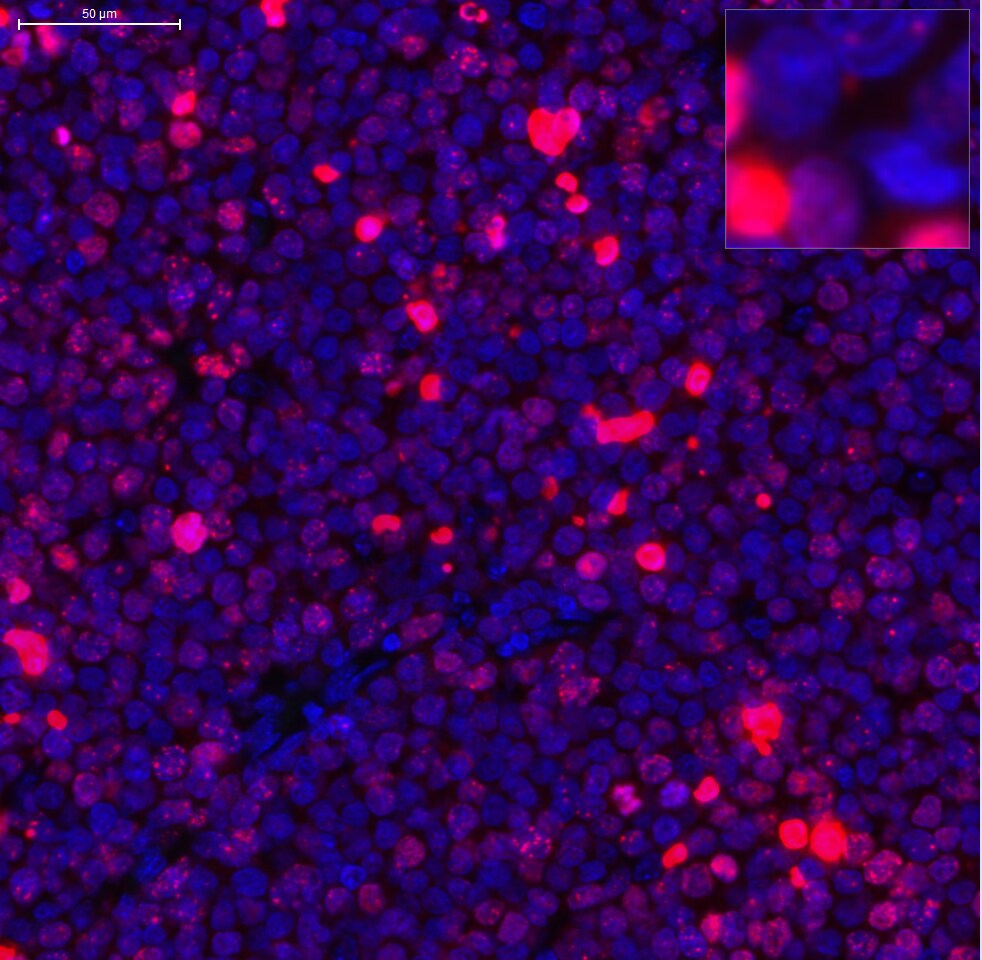 Histone H2AX [p Ser139] Antibody NB100-2280