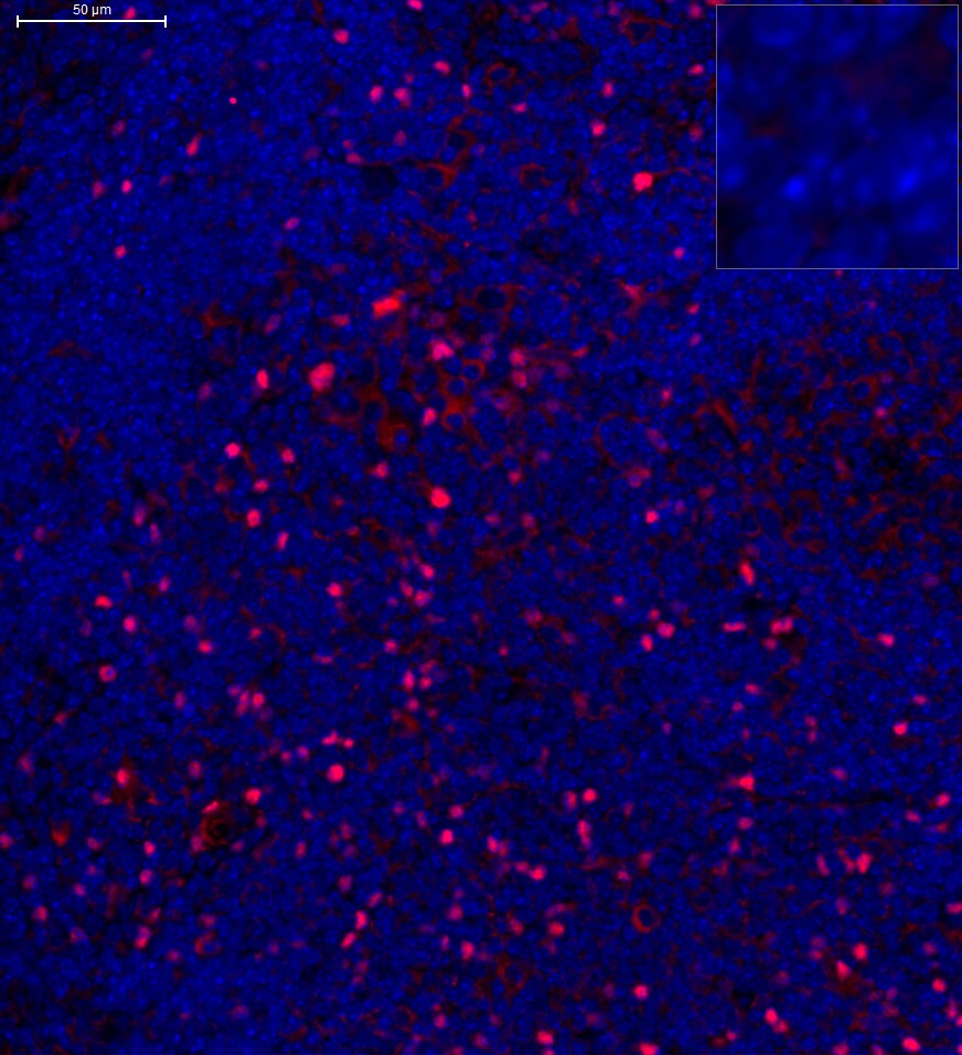 FoxP3 Antibody - BSA Free NB100-39002