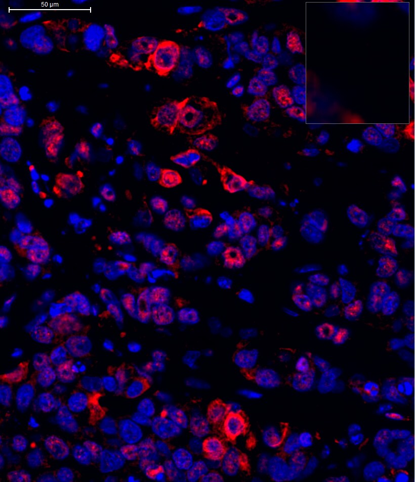 Lysine (K)-specific Demethylase 5B/KDM5B/JARID1B Antibody - BSA Free NB100-97821