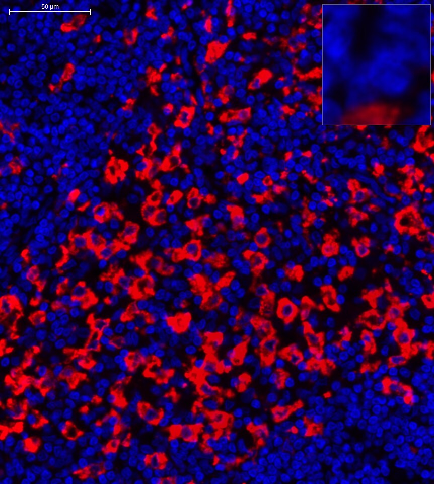 CD163 Antibody (10D6) NB110-59935