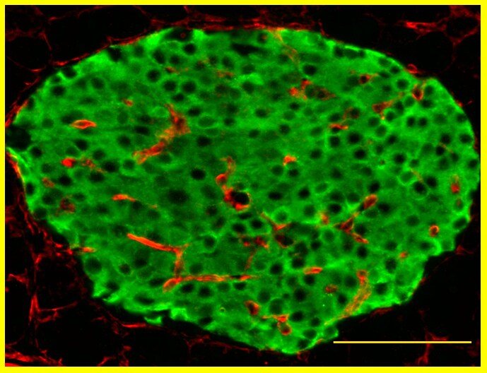 Collagen IV Antibody [Biotin] NB120-6581