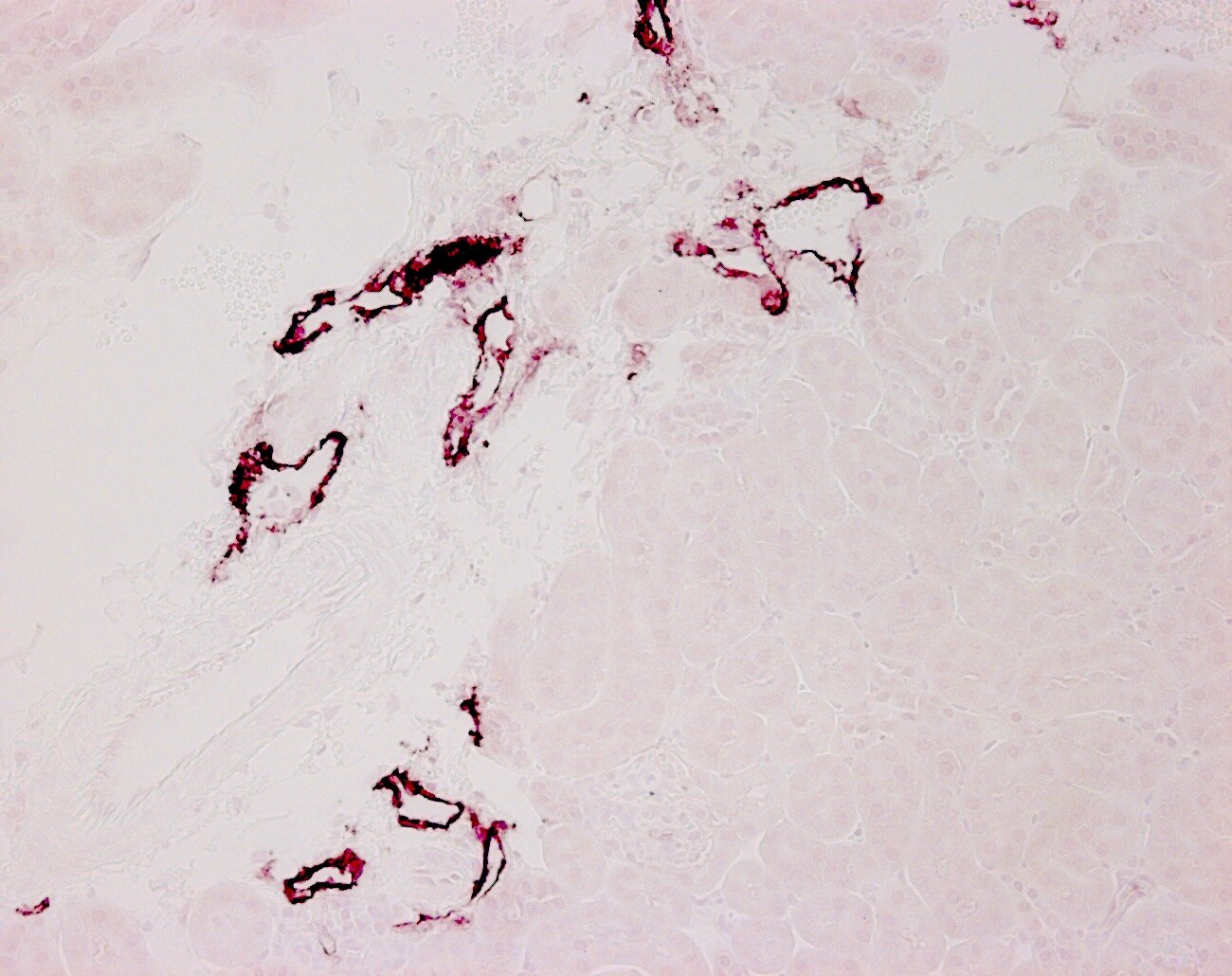 LYVE-1 Antibody - Azide and BSA Free NB600-1008
