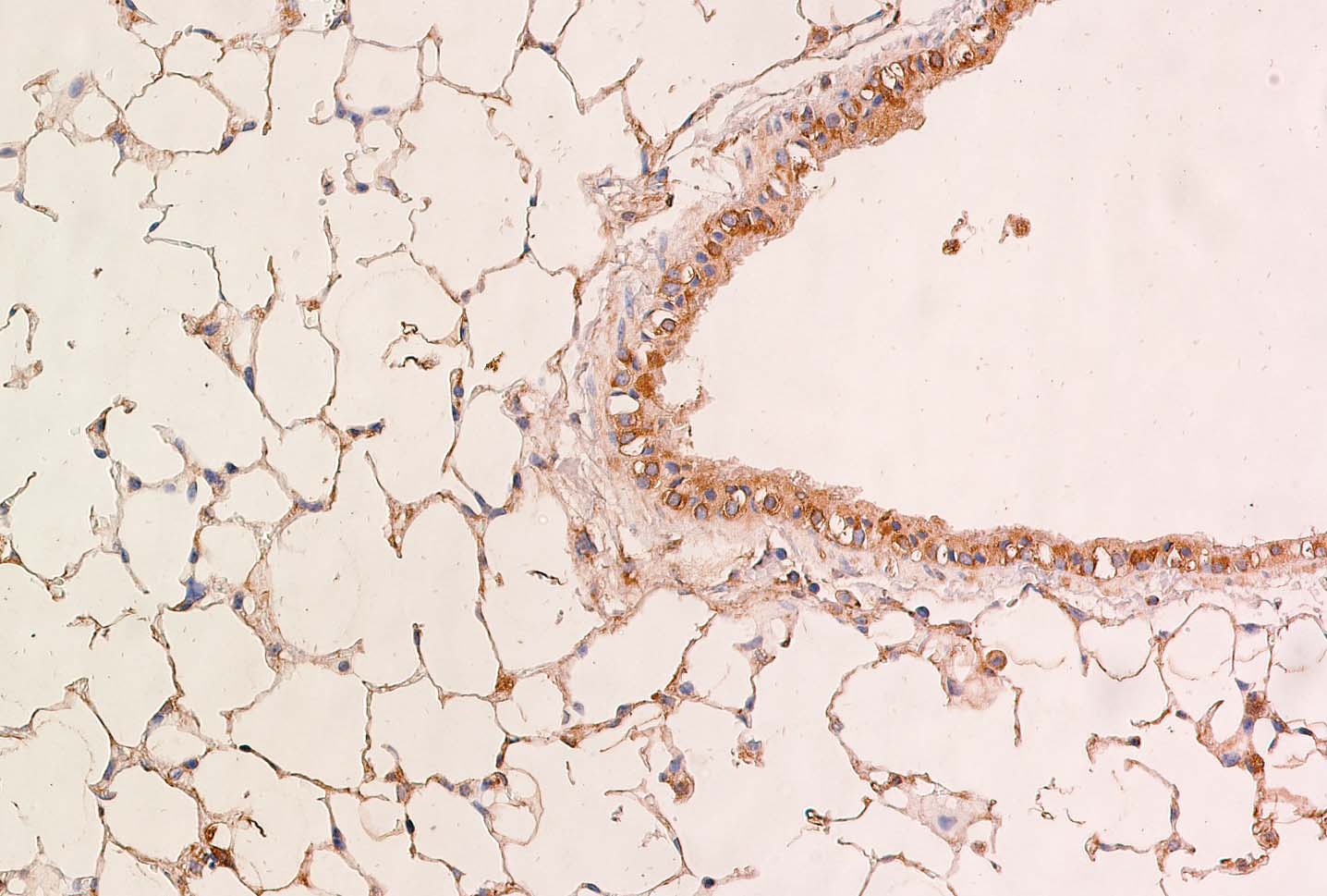 Rhot1 Antibody - BSA Free NBP1-59021