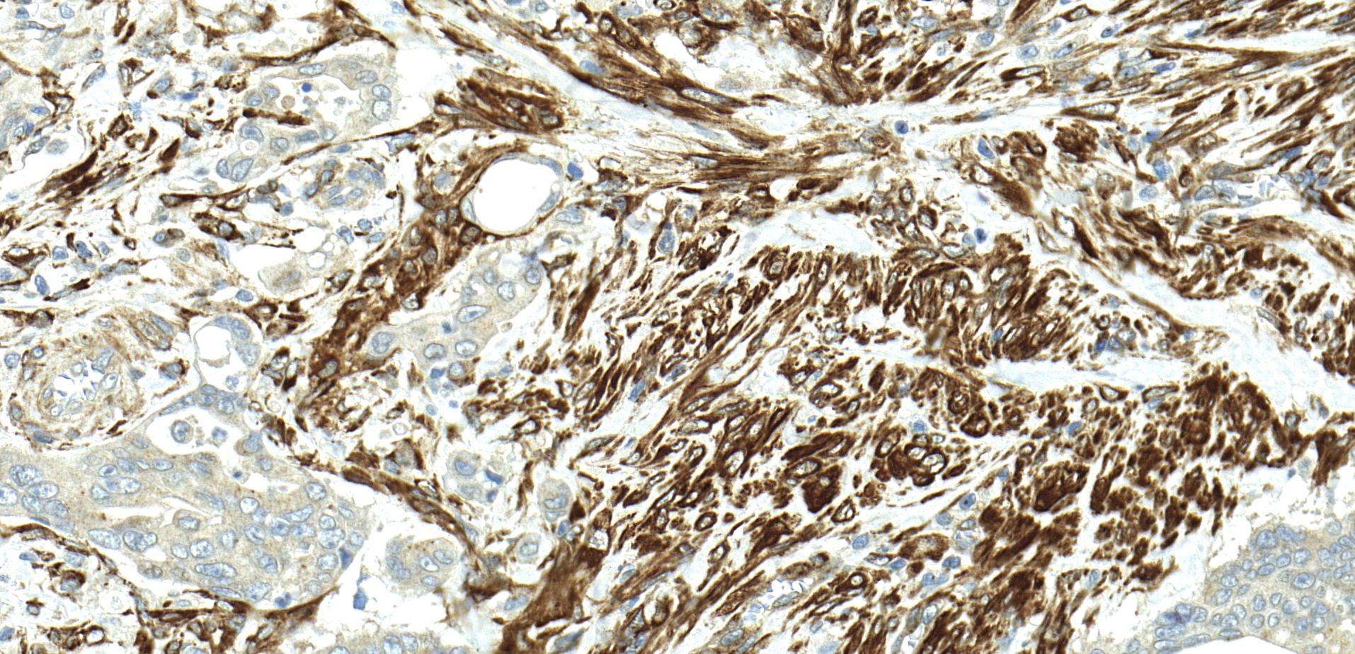 Dicer Antibody - BSA Free NBP1-71691