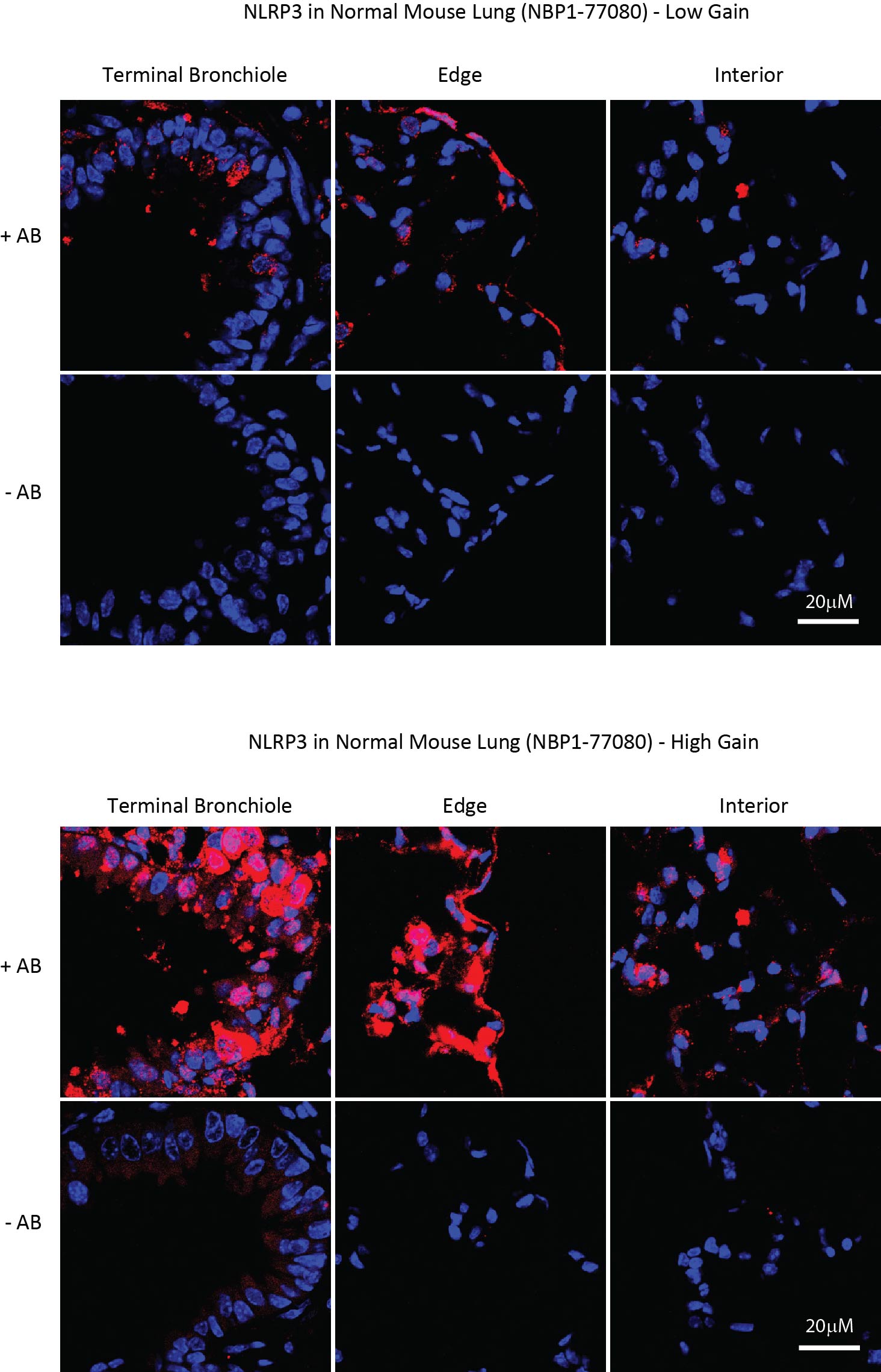 NLRP3/NALP3 Antibody - BSA Free NBP1-77080