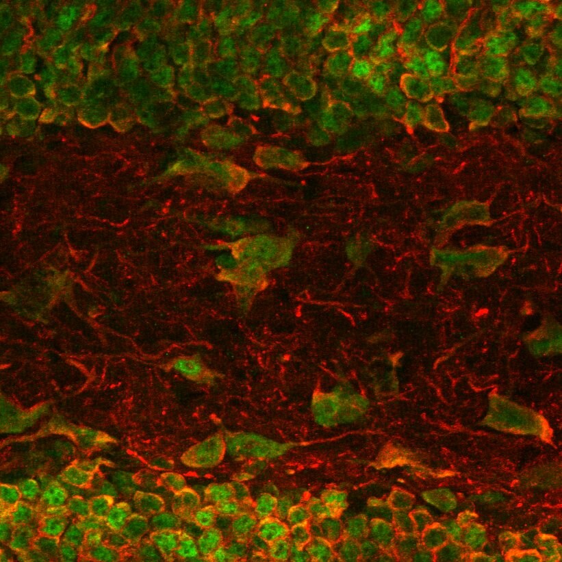 MAP2 Antibody (4H5) - BSA Free NBP2-25156