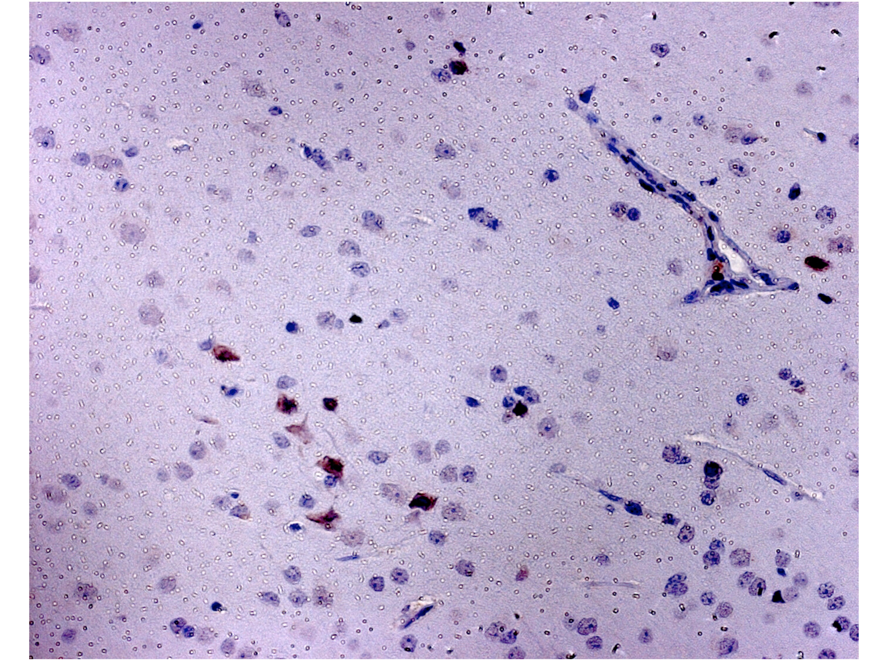 CCR5 Antibody - BSA Free NBP2-31374