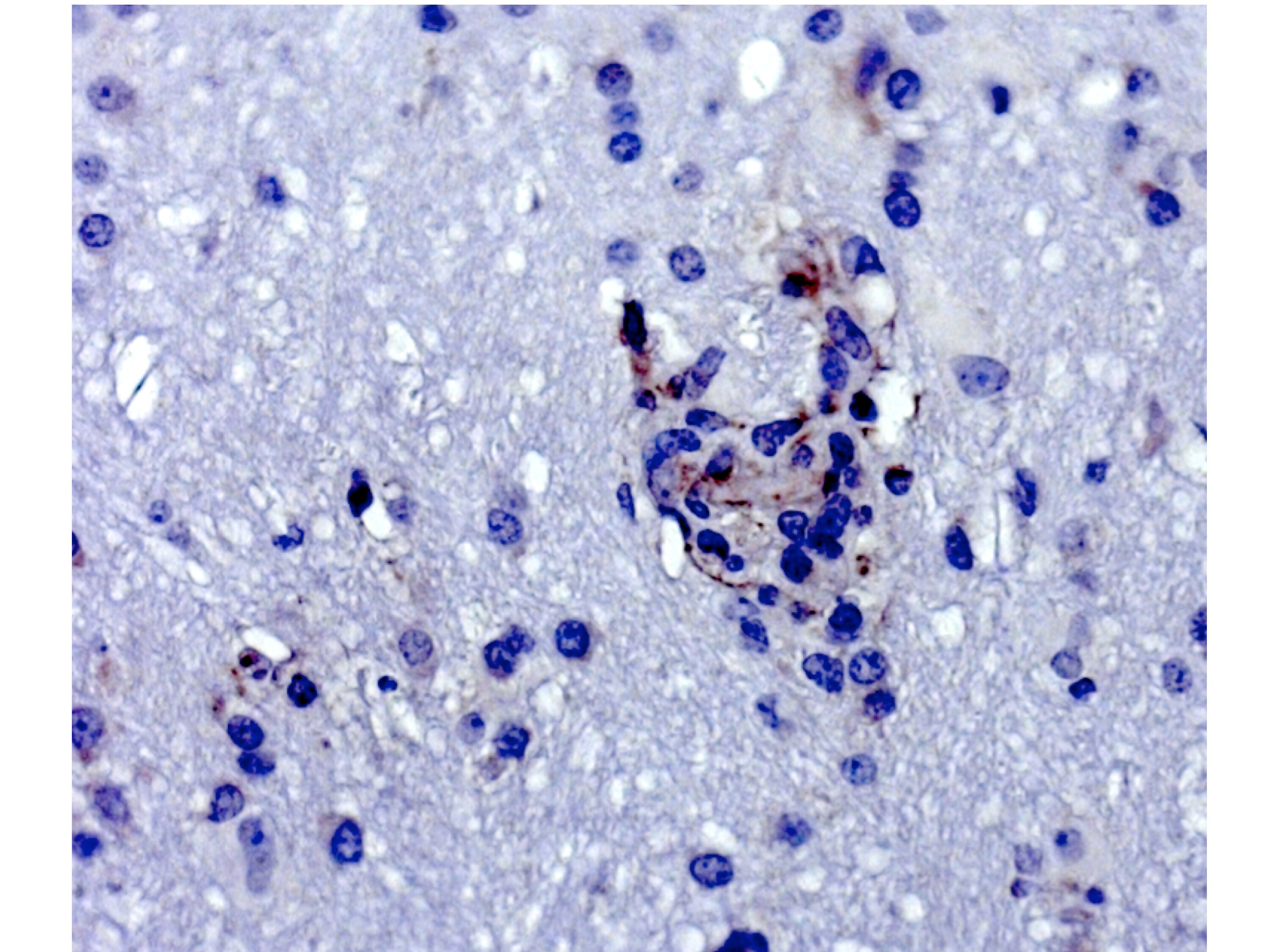 IFIT1 Antibody - BSA Free NBP2-33751