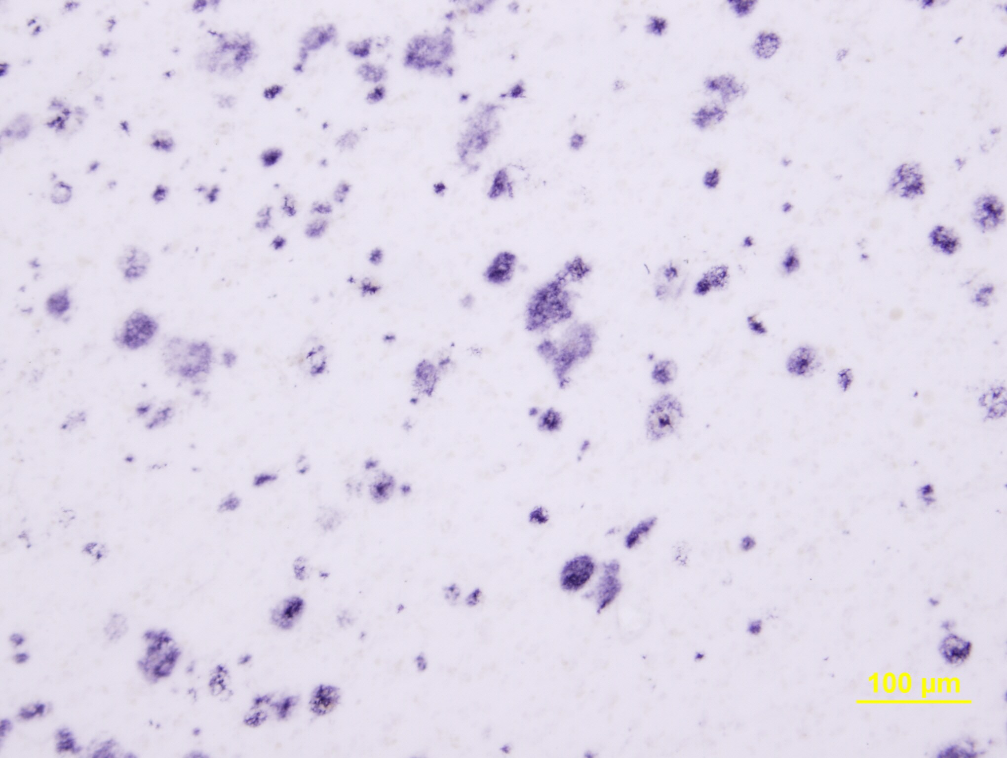 beta Amyloid 42 Antibody - BSA Free NBP2-44113