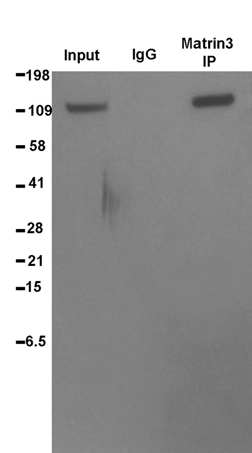Matrin 3 Antibody NB100-1761