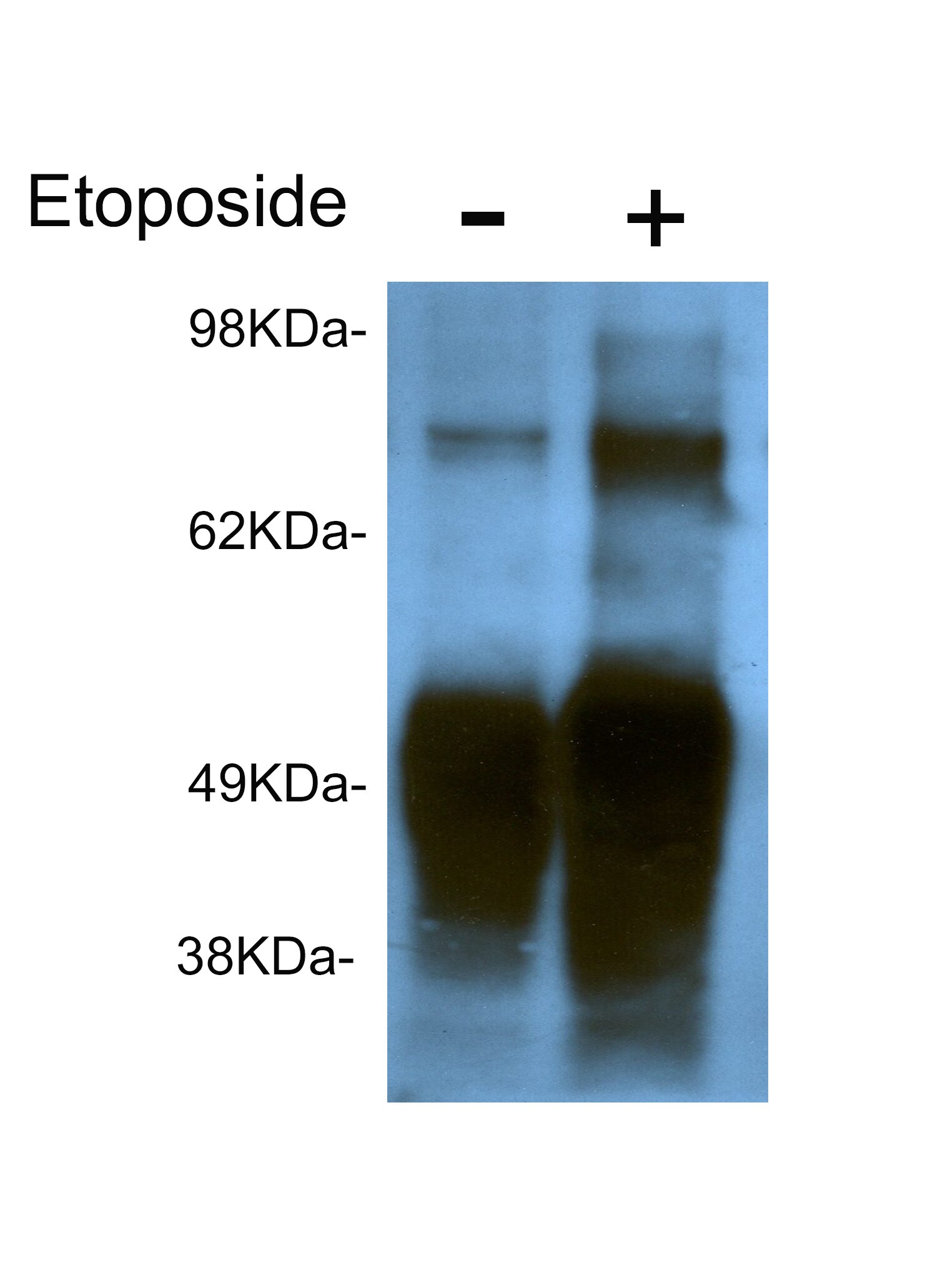 Rabbit IgG Isotype Control NBP2-24893