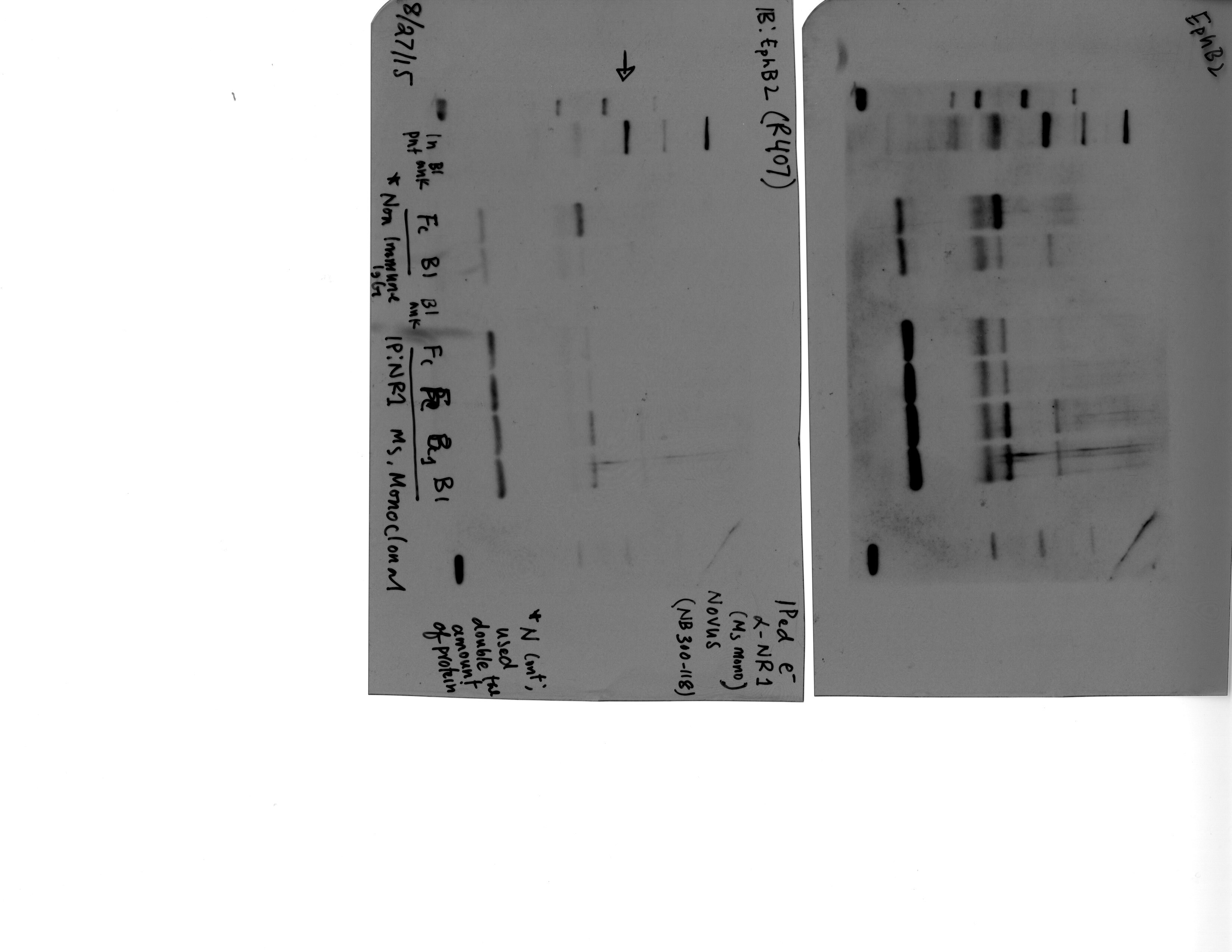 NMDAR1 Antibody (R1JHL) NB300-118