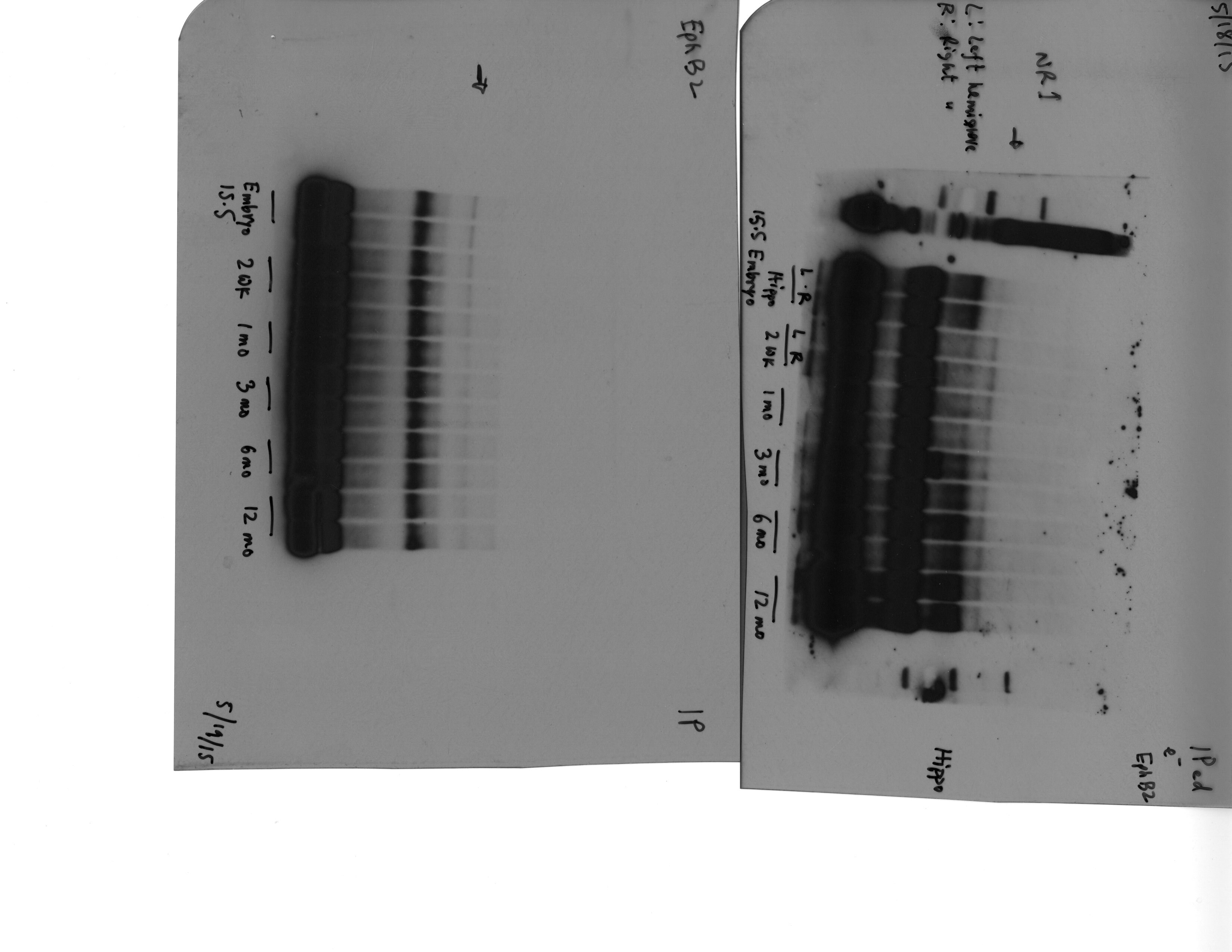 NMDAR1 Antibody (R1JHL) NB300-118