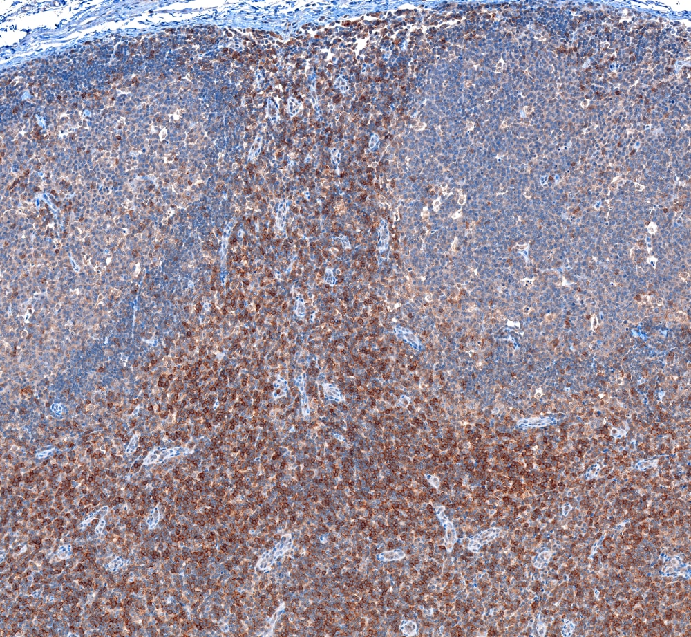 CD8 beta Antibody (039) - Azide and BSA Free NBP2-89751
