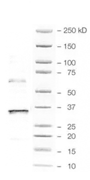 Human CCL20/MIP‑3 alpha  Antibody MAB360