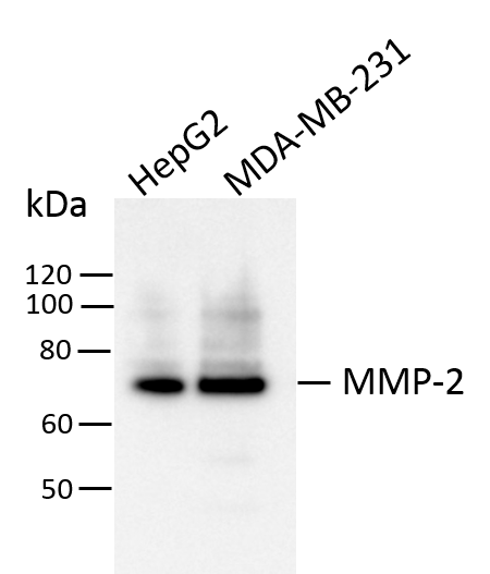Human MMP‑2 Antibody MAB9022