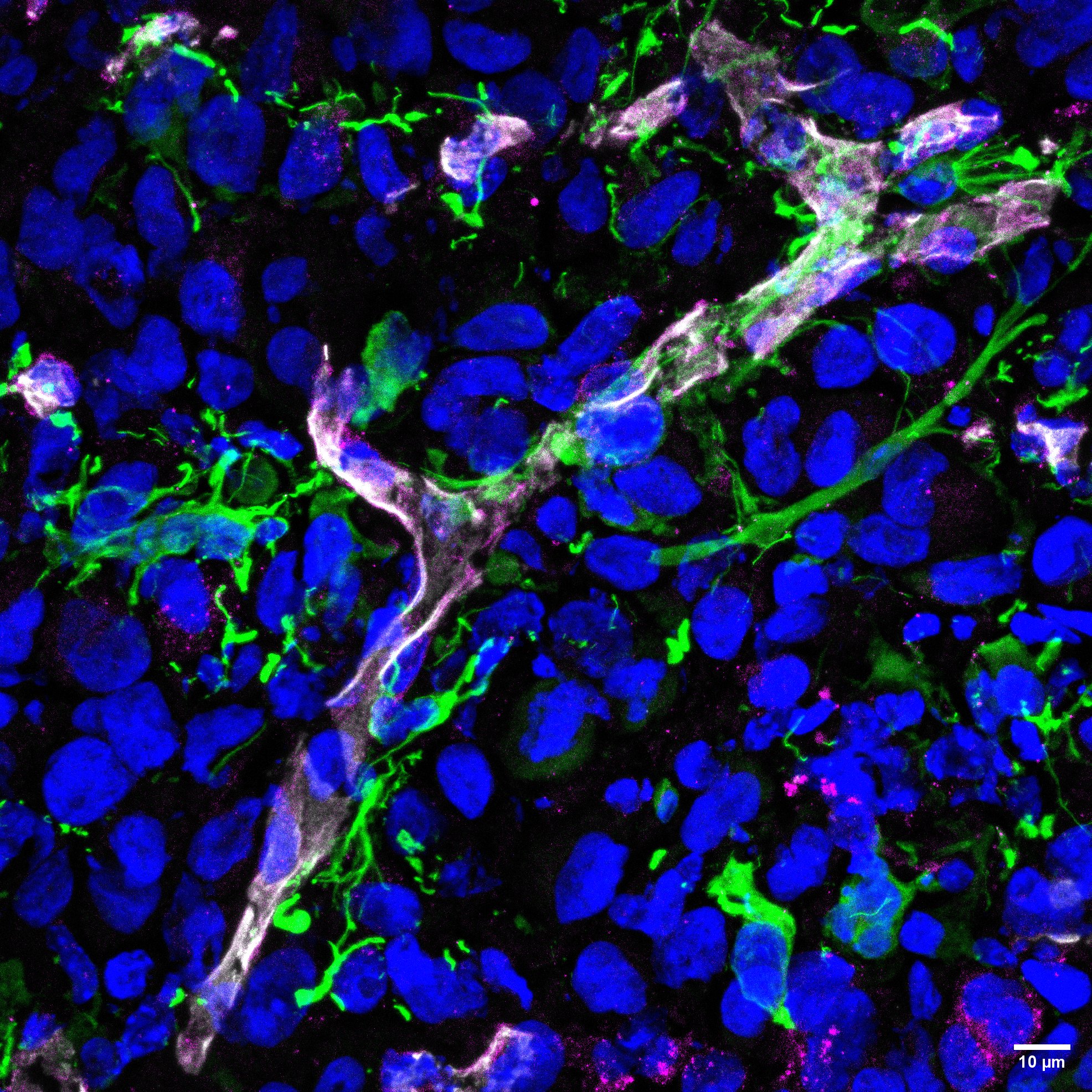 Human PDGF R alpha Antibody AF-307-NA