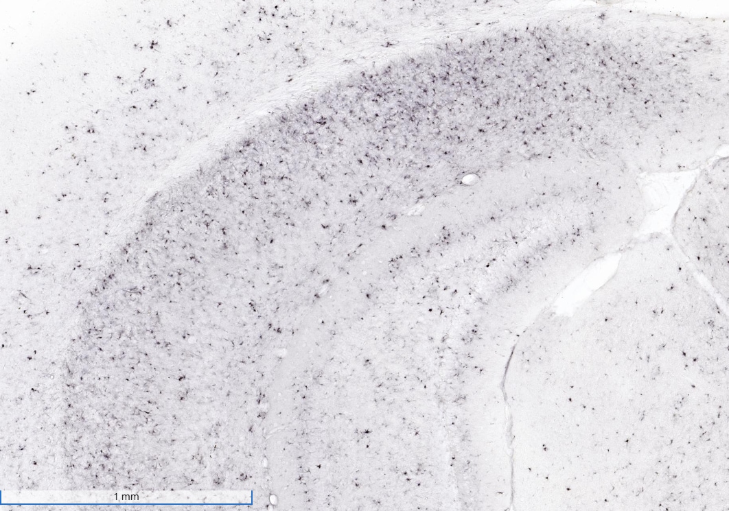 Human/Mouse TREM2 Antibody MAB17291