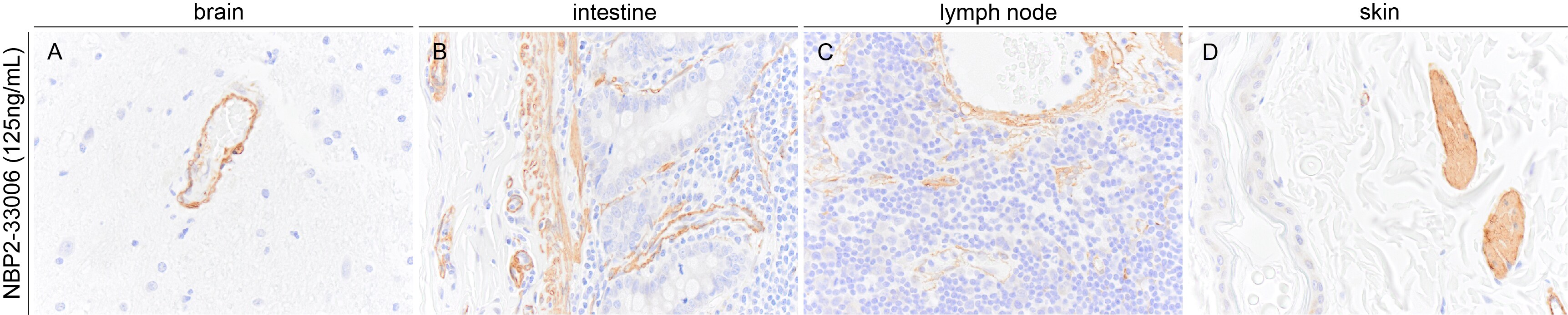 alpha-Smooth Muscle Actin Antibody (1A4/asm-1) - BSA Free NBP2-33006