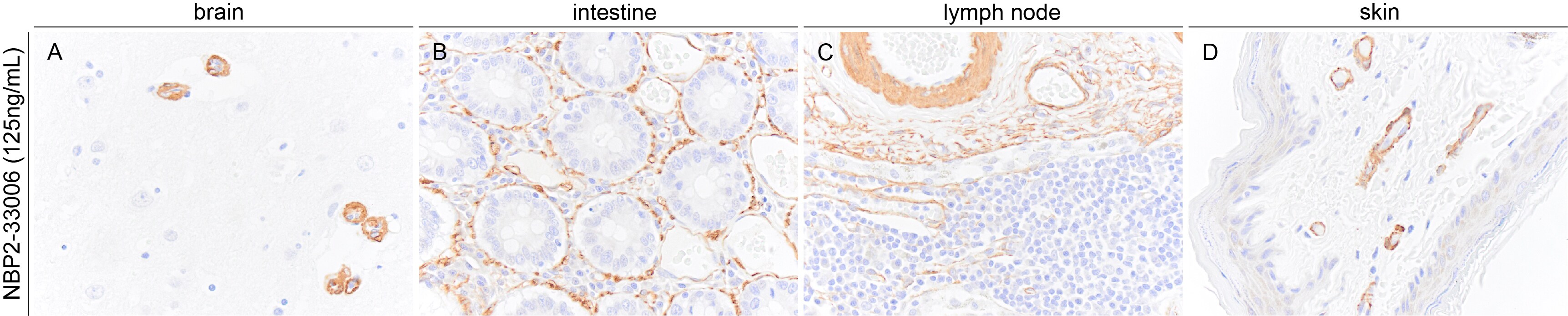 alpha-Smooth Muscle Actin Antibody (1A4/asm-1) - BSA Free NBP2-33006