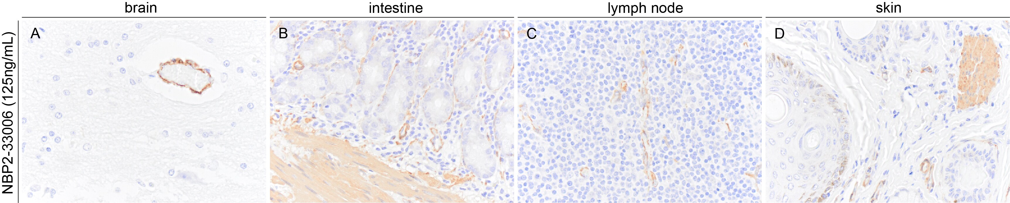 alpha-Smooth Muscle Actin Antibody (1A4/asm-1) - BSA Free NBP2-33006