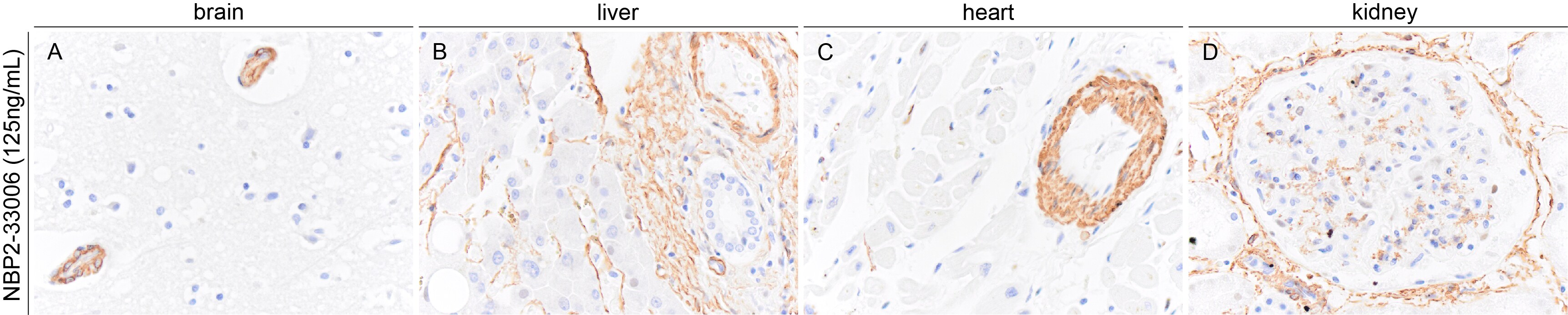 alpha-Smooth Muscle Actin Antibody (1A4/asm-1) - BSA Free NBP2-33006
