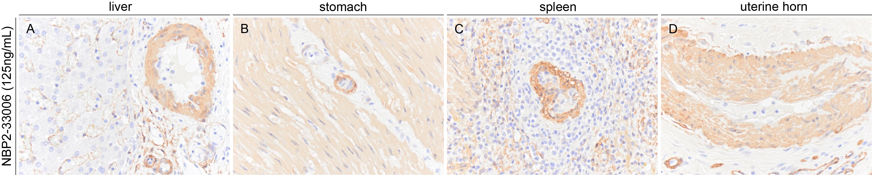 alpha-Smooth Muscle Actin Antibody (1A4/asm-1) - BSA Free NBP2-33006