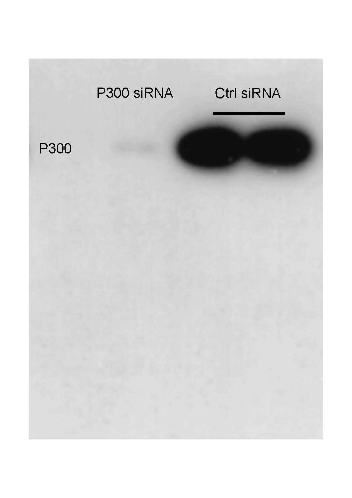 KAT3B/p300 Antibody (RW105) - BSA Free NB100-616