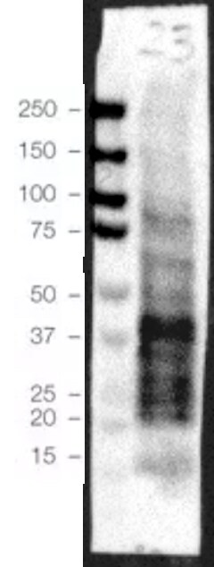 Olig2 Antibody NBP1-30650
