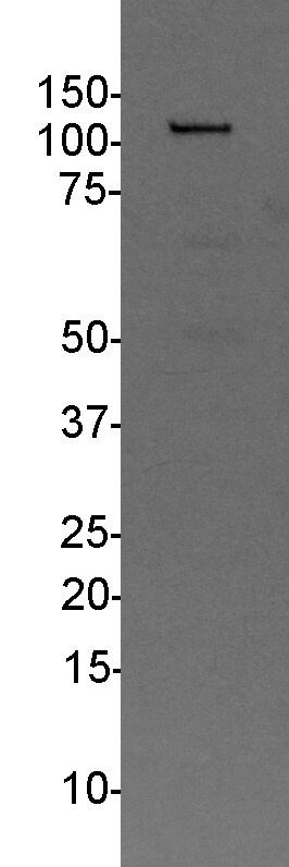LRRFIP1 Antibody NBP1-71835